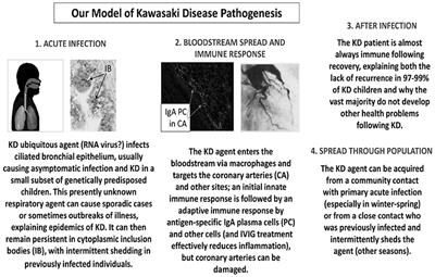 The Epidemiology and Pathogenesis of Kawasaki Disease